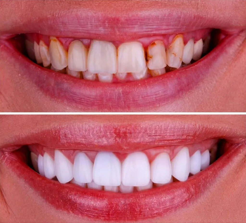 Ortodonzia - Clinica Dentale Albania | Tirana e Valona