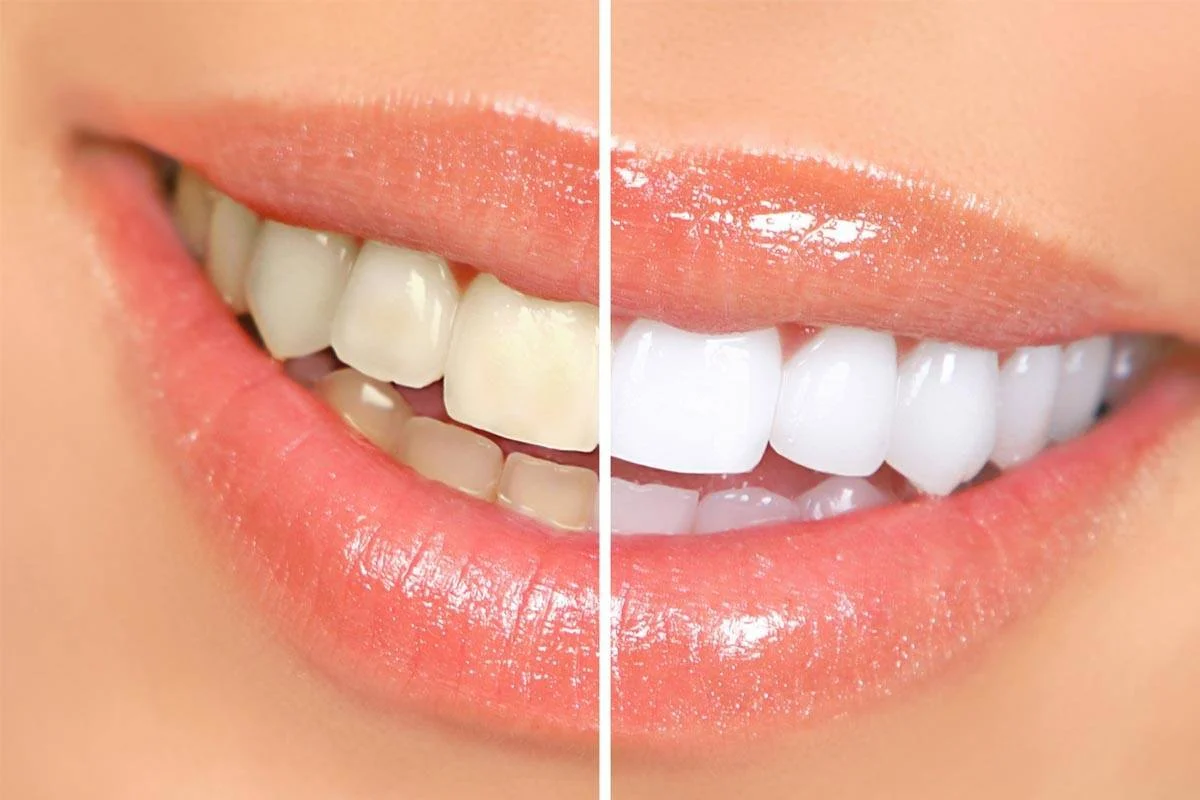 dentista estetico