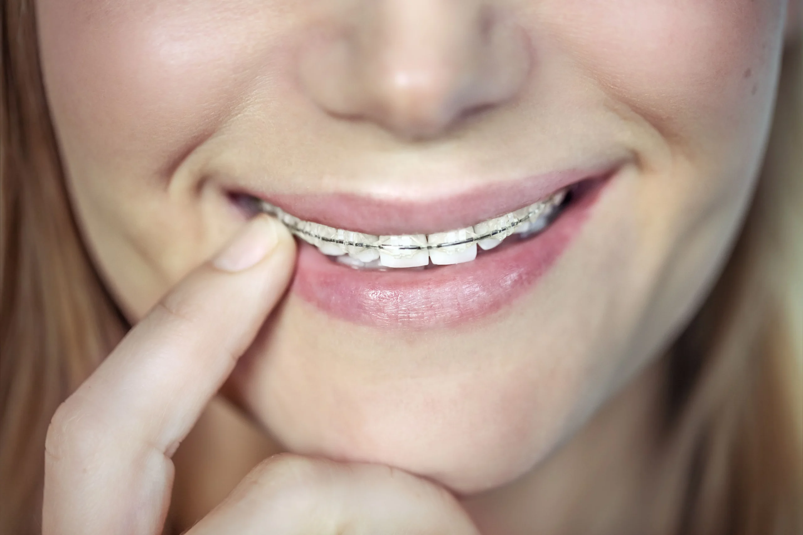 Braces UK Price1