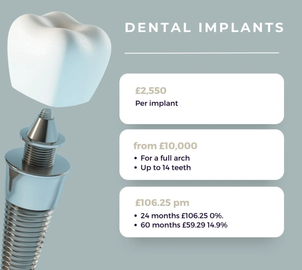 Dental Implants NHS