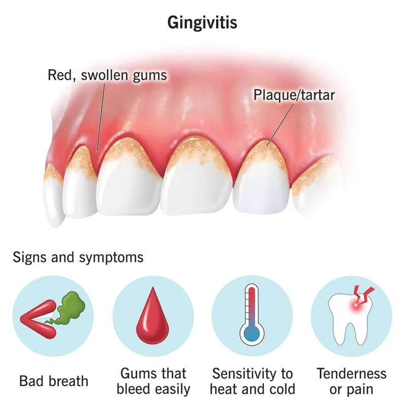 How To Cure Gum Disease