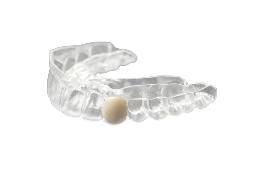 Replacement Retainer