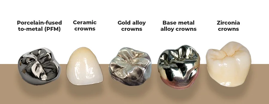 Types Of Crowns