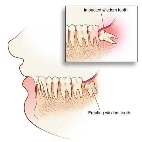 Wisdom Extraction