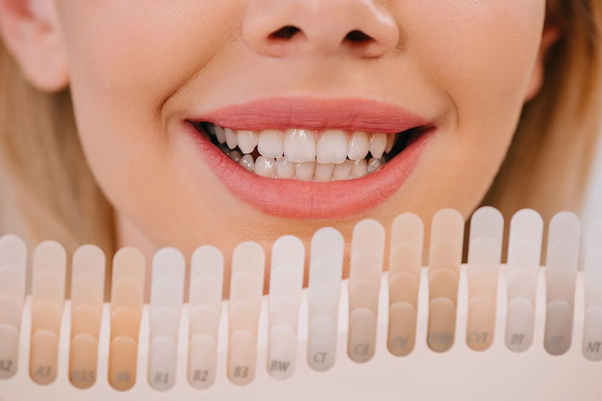 DENTI PERFETTI1