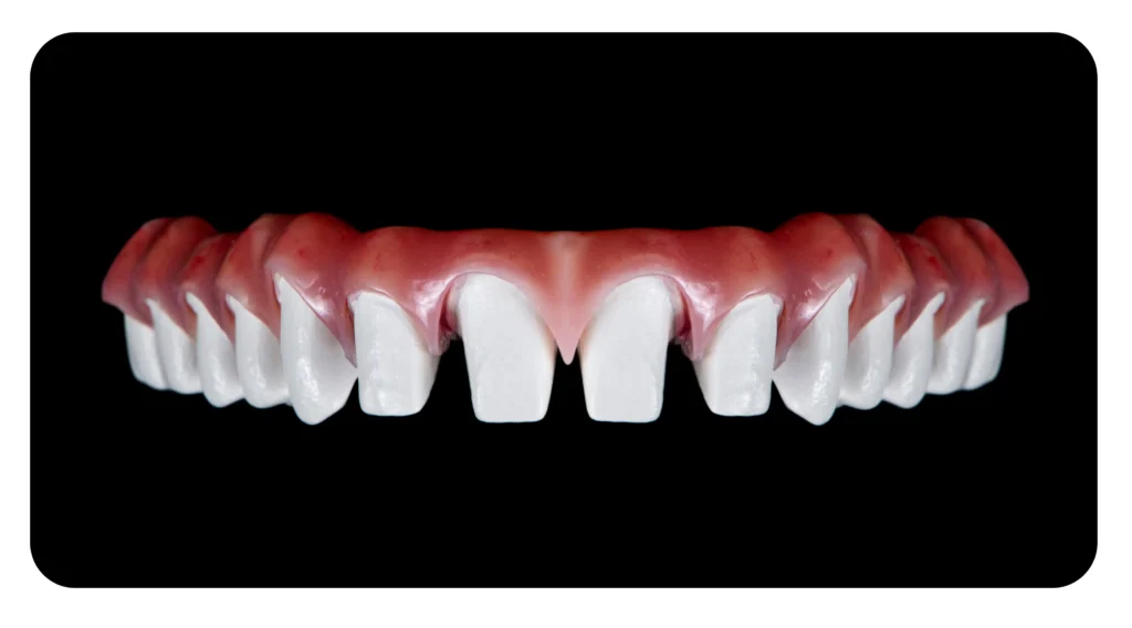 Denti Limati Per Faccette