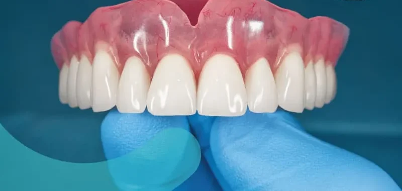 Denti Protesi Mobili