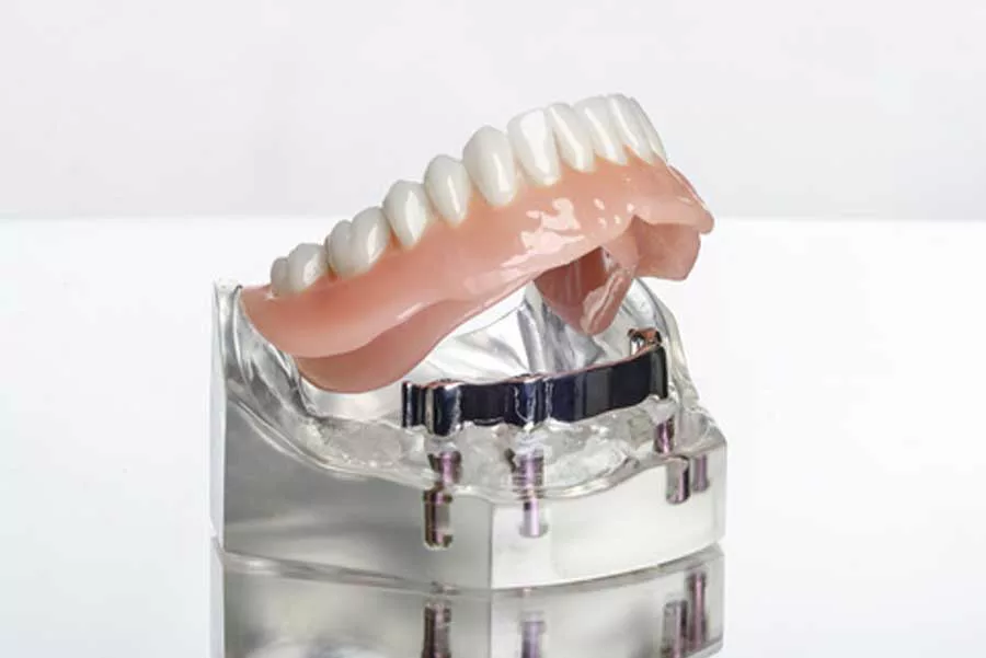 PROTESI DENTARIE MATERIALI