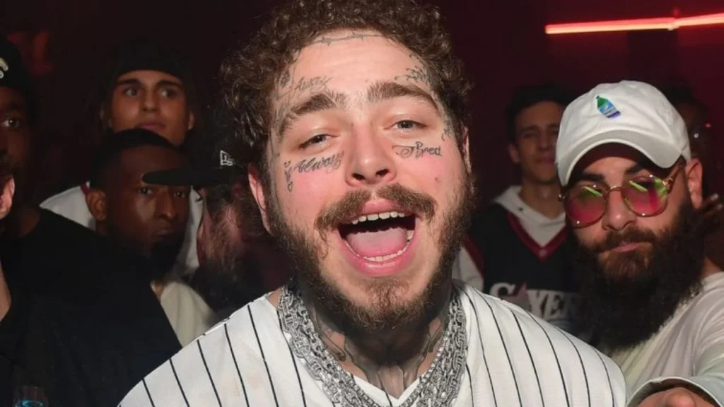 Post Malone Denti