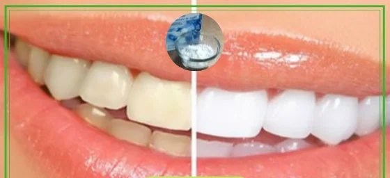 sbiancare i denti con bicarbonato