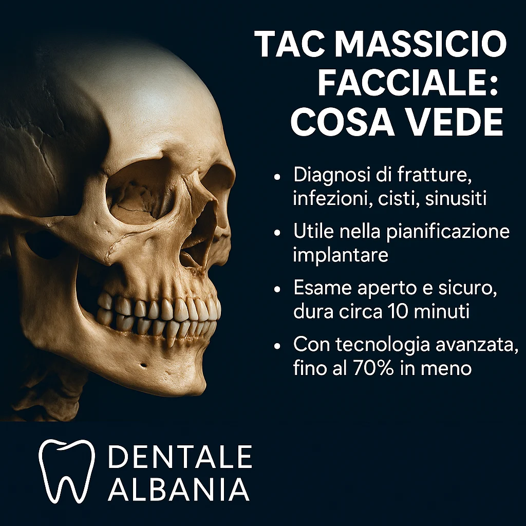 TAC massiccio facciale: cosa vede