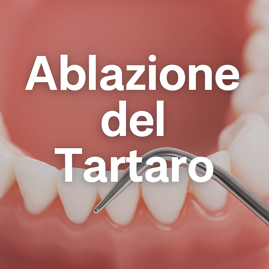 ablazione del tartaro