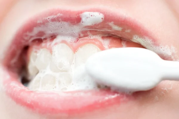 Come Sbiancare i Denti a Casa