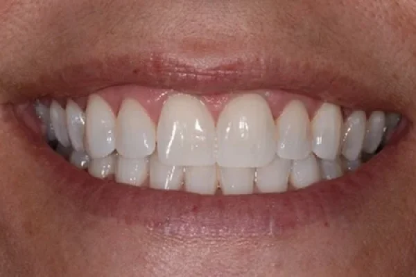 Cosmetic Dentist Near Me1