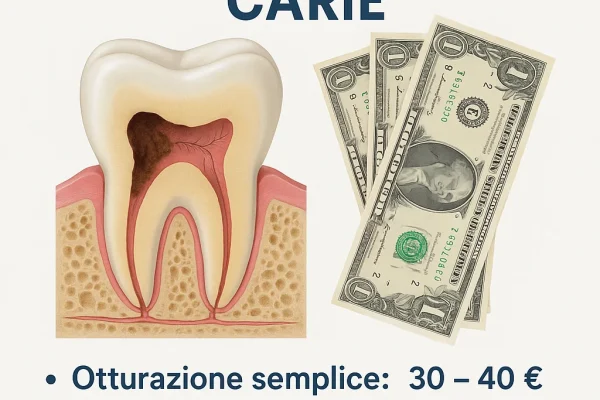 Costi otturazione carie