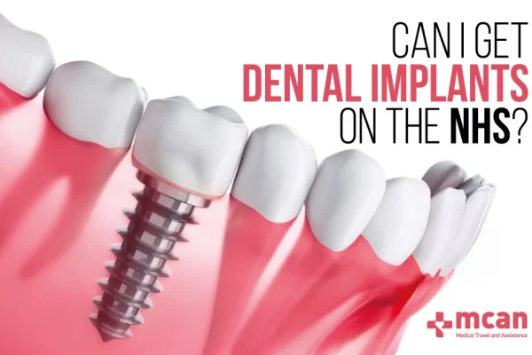 Dental Implants On The NHS