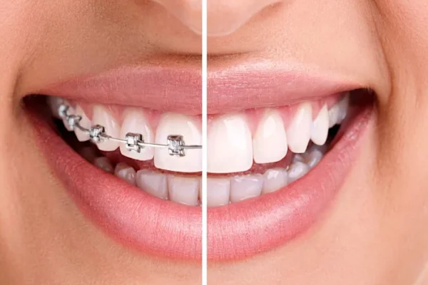 Dentista Apparecchio2