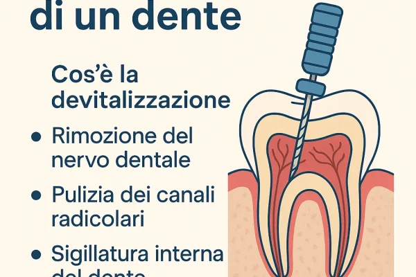 Devitalizzazione di un dente