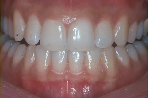 HEALTHY GUMS1