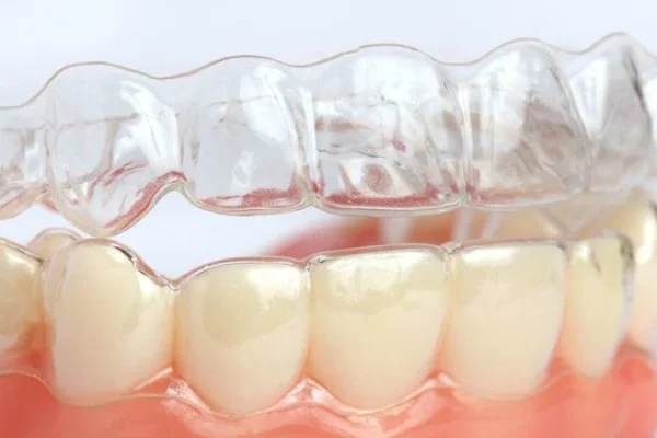 Mascherina Per Denti Trasparente1