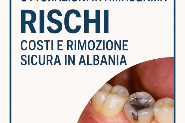 Otturazioni in amalgama