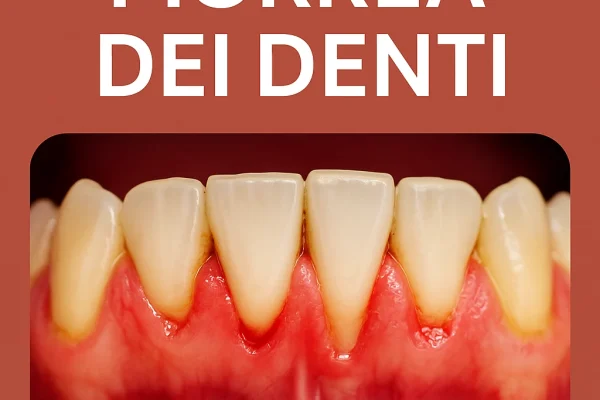 Piorrea dei denti