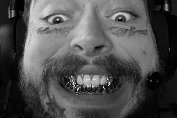 Post Malone Denti