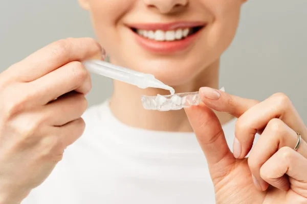 Sbiancamento Dentale Con Mascherine1