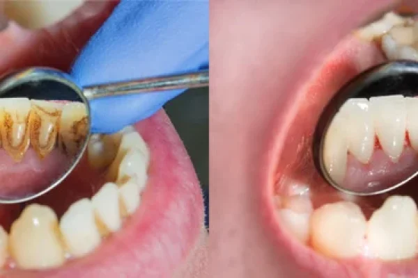 What Do Hygienist Do