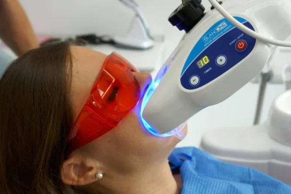 sbiancante per denti3