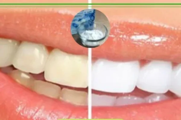 sbiancare i denti con bicarbonato